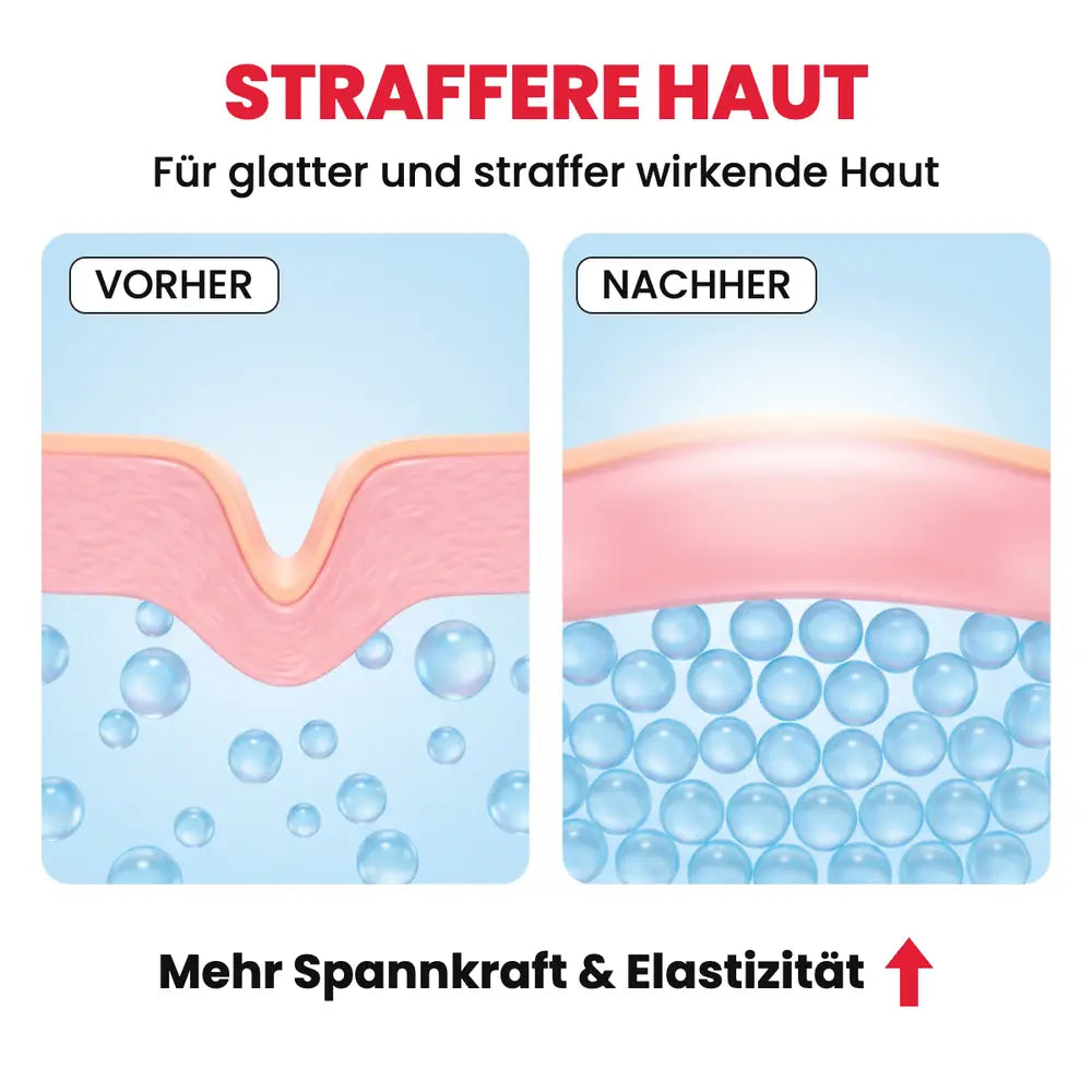 Straffere Haut: Hautschnitt vorher und nachher