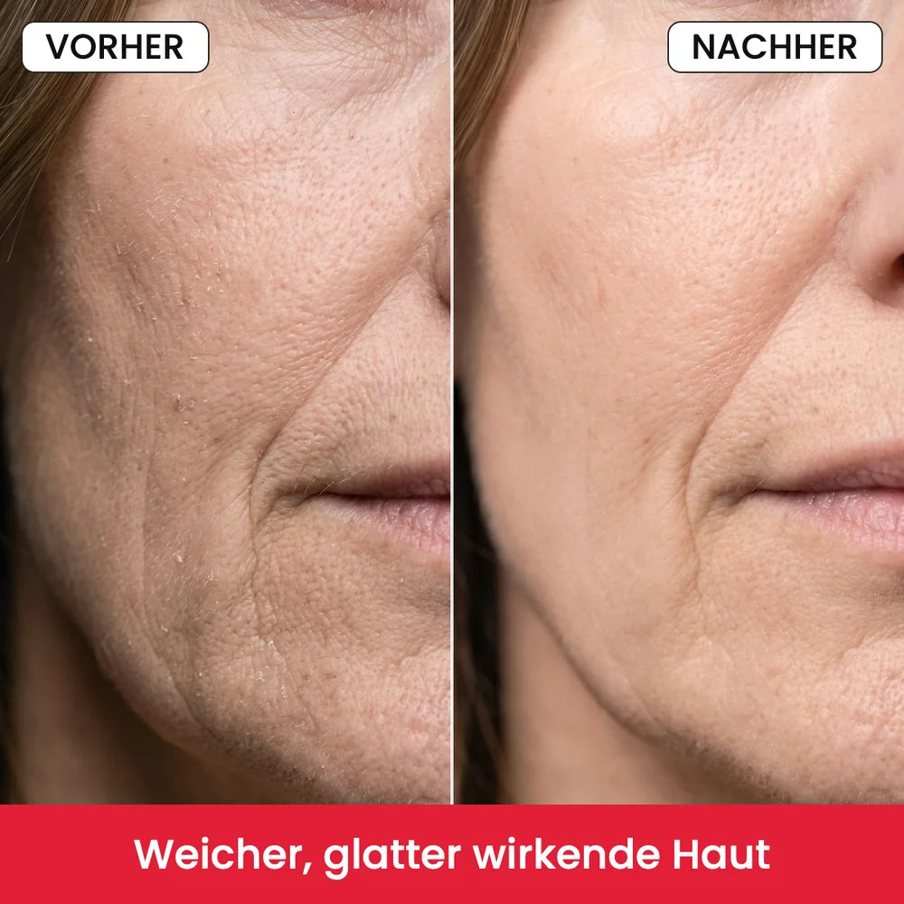 Vorher/Nachher: weicher, glatter wirkende Haut an der Wange, Symbolbild