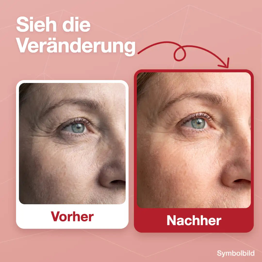 Vorher/Nachher Augenpartie, Symbolbild