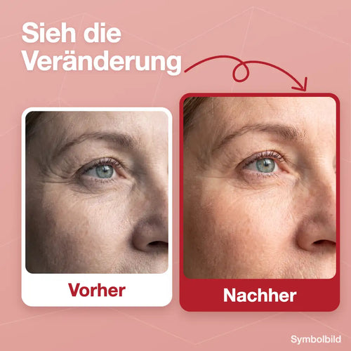 Vorher/Nachher Augenpartie, Symbolbild